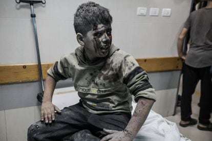 Un niño palestino herido durante un ataque israelí es tratado en el hospital Nasser, este lunes en Jan Yunis. 
