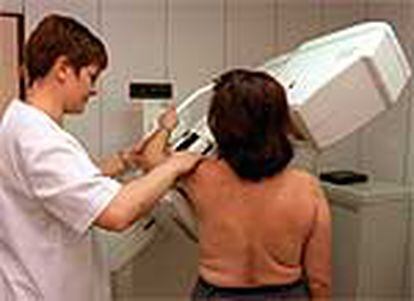 Una mujer se somete a una mamografía en la sede de la Asociación contra el Cáncer de Madrid.