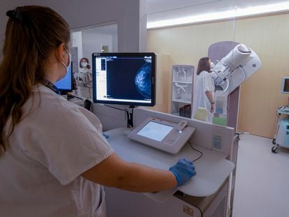 Sección de Radiología de la Mujer del Hospital Vall d'Hebron, de Barcelona, durante una prueba de una paciente.