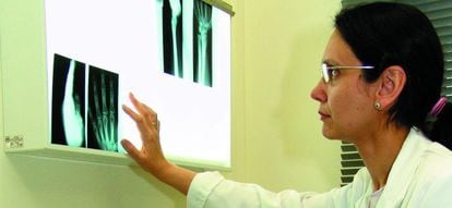 Una doctora de la mutua Asepeyo mirando la radiograf&iacute;a de un trabajador.