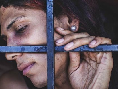 Una mujer transgénero muestra sus heridas en el centro de detención de Valencia, Carabobo (Venezuela), en 2017.