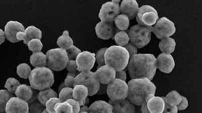 Imagen (microscopía electrónica) de nanopartículas de un compuesto.