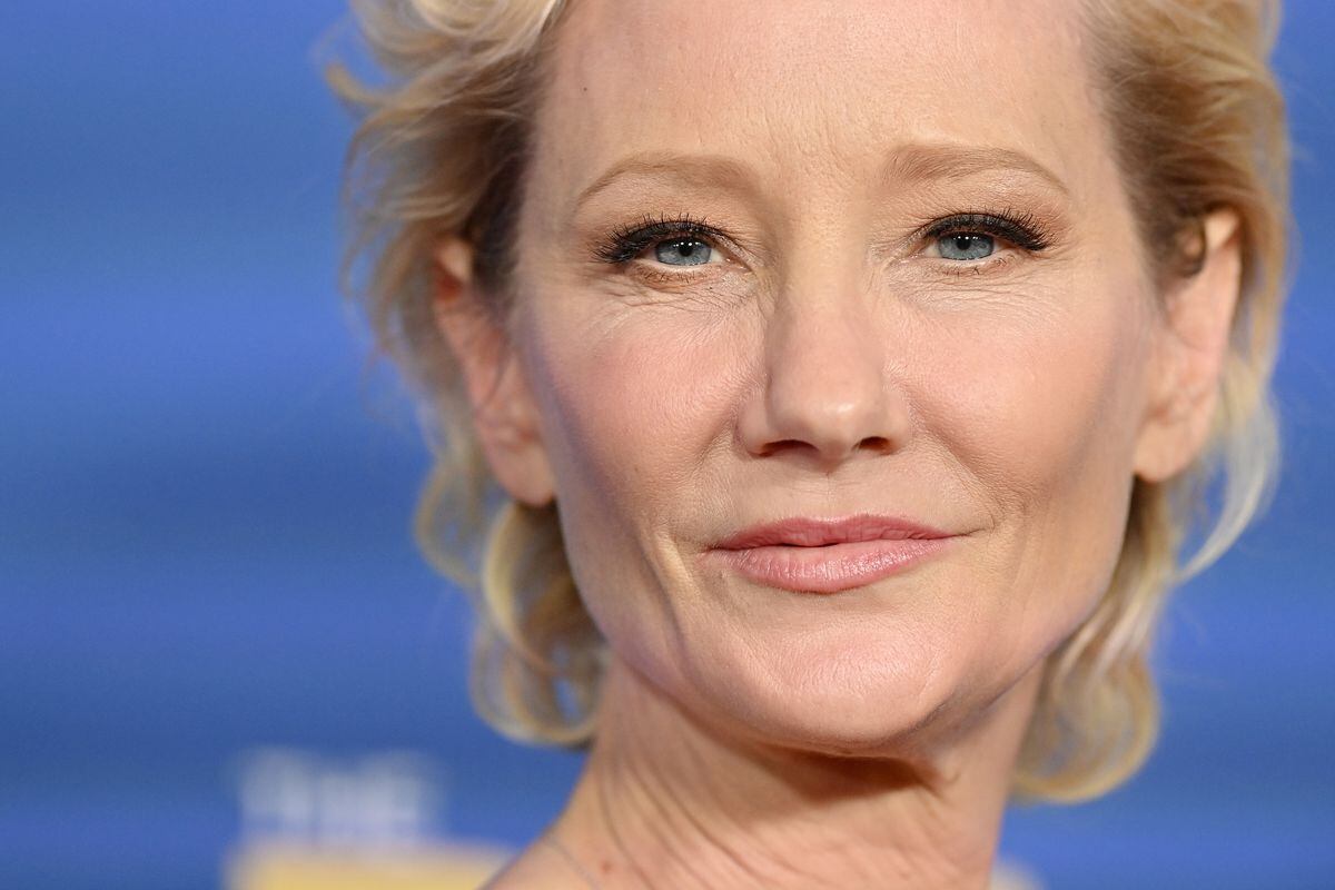 Actress Anne Heche Hospitalized With Burns After Crashing Her Car Into A House Pledge Times 0816