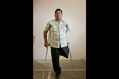 Benito Murillo (43 a&ntilde;os) integrante de la AMIREDIS (Asociaci&oacute;n de Migrantes Retornados con Discapacidad). Ciudad de M&eacute;xico. 12 de abril, 2014. 