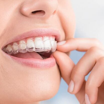 ▷【 Pastillas para limpiar Prótesis dentales y luce sonrisa 2024