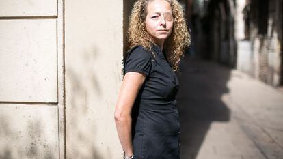 Ester Quintana perdió un ojo el 14- N tras una manifestación en Barcelona.