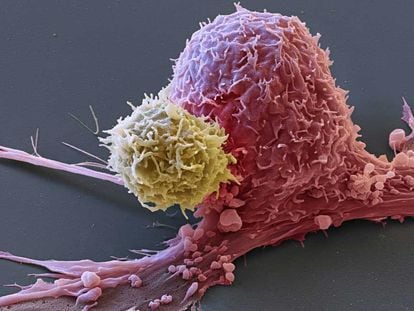 Imagen de una célula tumoral (rosa) atacada por un linfocito T (amarillo).