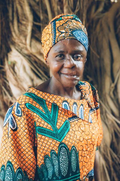 Mulikat Okanlawon, de 38 años superviviente de noma en Nigeria