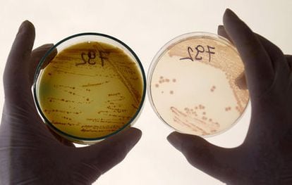 Un empleado de la Dirección de Seguridad Alimentaria realiza pruebas para la bacteria E.Coli a los pepinos húngaros en Budapest, en foto de archivo.