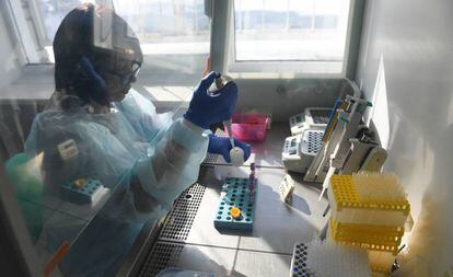 Una científica realiza pruebas bacteriológicas en el Instituto de Investigación de la Tuberculosis de Novosibirsk, Rusia.