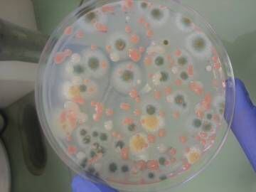 Colonias de hongos diferentes procedentes de muestras obtenidas en la ISS.