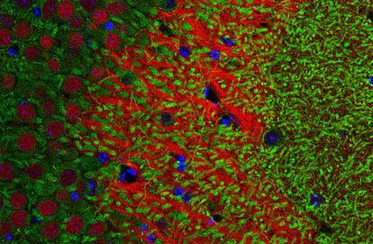 Detección de la proteína (en verde) del gen `Crtc1´ en neuronas del hipocampo del ratón con alzhéimer.