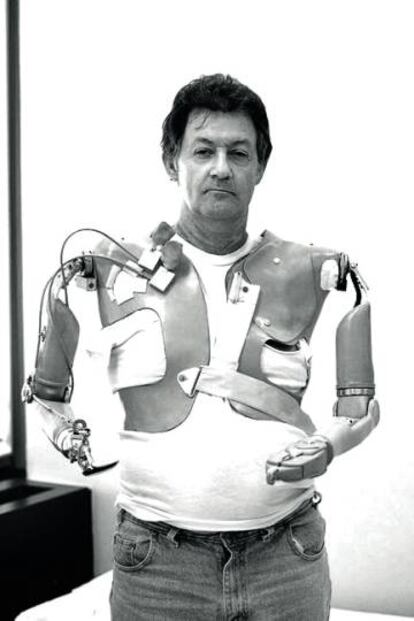 Jesse Sullivan, al que le fueron implantados unos brazos biónicos que responden a sus estímulos nerviosos.