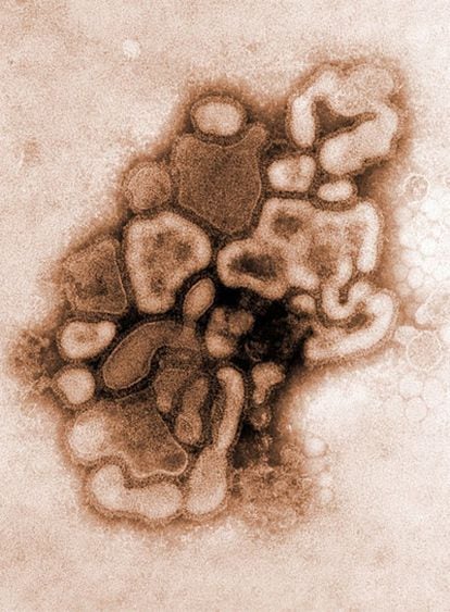 Imagen coloreada del virus A H1N1 tomada por un microscopio electrónico de un brote de 1976 y difundida por el Centros para el Control y la Prevención de Enfermedades de EE UU.