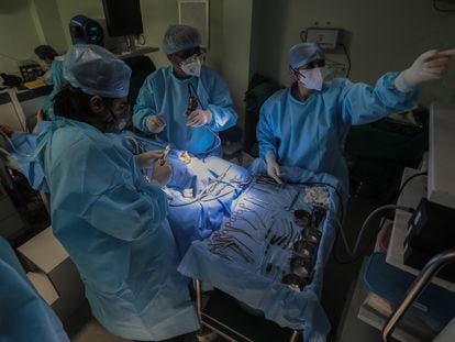 Médicos realizan una cirugía endoscópica en un paciente con mucormicosis en India, el pasado 3 de junio.