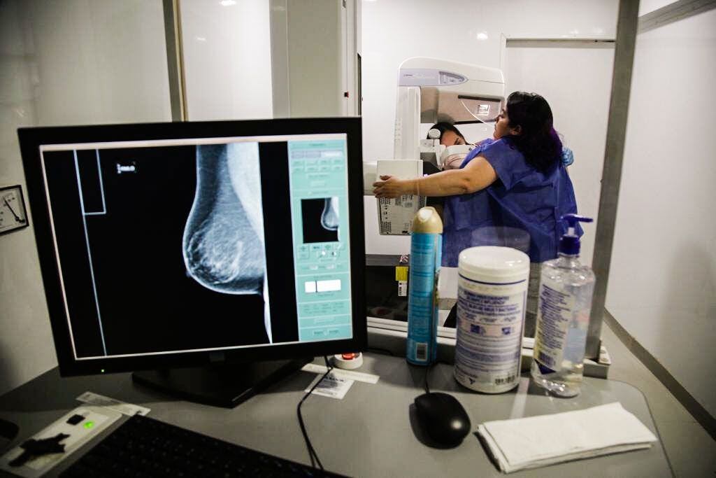 Una doctora realiza una mastografía a una paciente, en un hospital en Ciudad de México, el 6 de julio de 2023. 