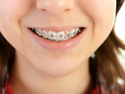 Brackets, la reinvención de la ortodoncia