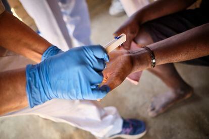 Detalle de la prueba de sensibilidad táctil de las manos mediante microfilamento para detectar lepra.