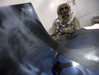 Un paciente que padece tuberculosis recibe tratamiento en un hospital local en Peshawar, Pakistán. La tuberculosis es una de las enfermedades que ha generado en muchos casos resistencia a los antibióticos.