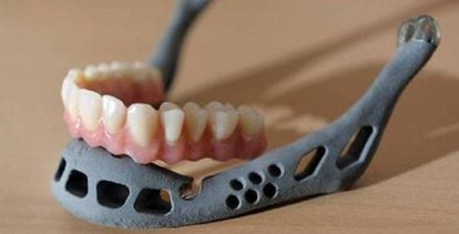 La parte inferior de la mandíbula, hecha de titanio, que se ha implantado al paciente.