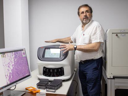 Marcial García, patólogo del Hospital Puerta del Mar de Cádiz, junto a una pantalla con células cancerosas.