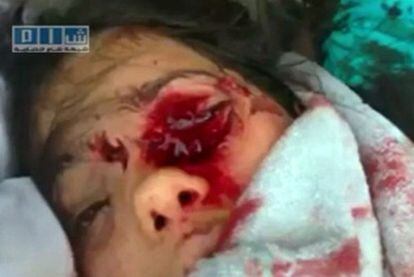 Una chica herida en los choques en Damasco, en una imagen grabada por un particular