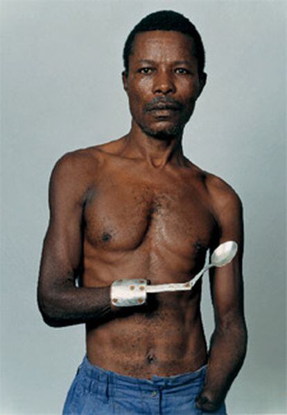 Mustafá Mandalay, amputado por los rebeldes de Sierra Leona.