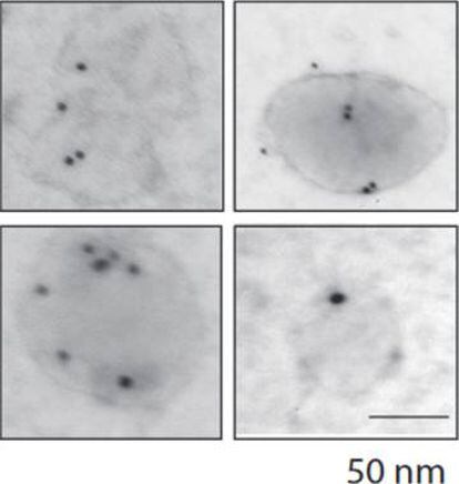 Vesículas en los vasos sanguíneos de un órgano captadas a través de un microscopio.