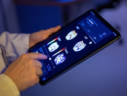 Un radiólogo en un hospital berlinés mira las imágenes del cerebro de un paciente a través de una 'app' basada en inteligencia artificial.
