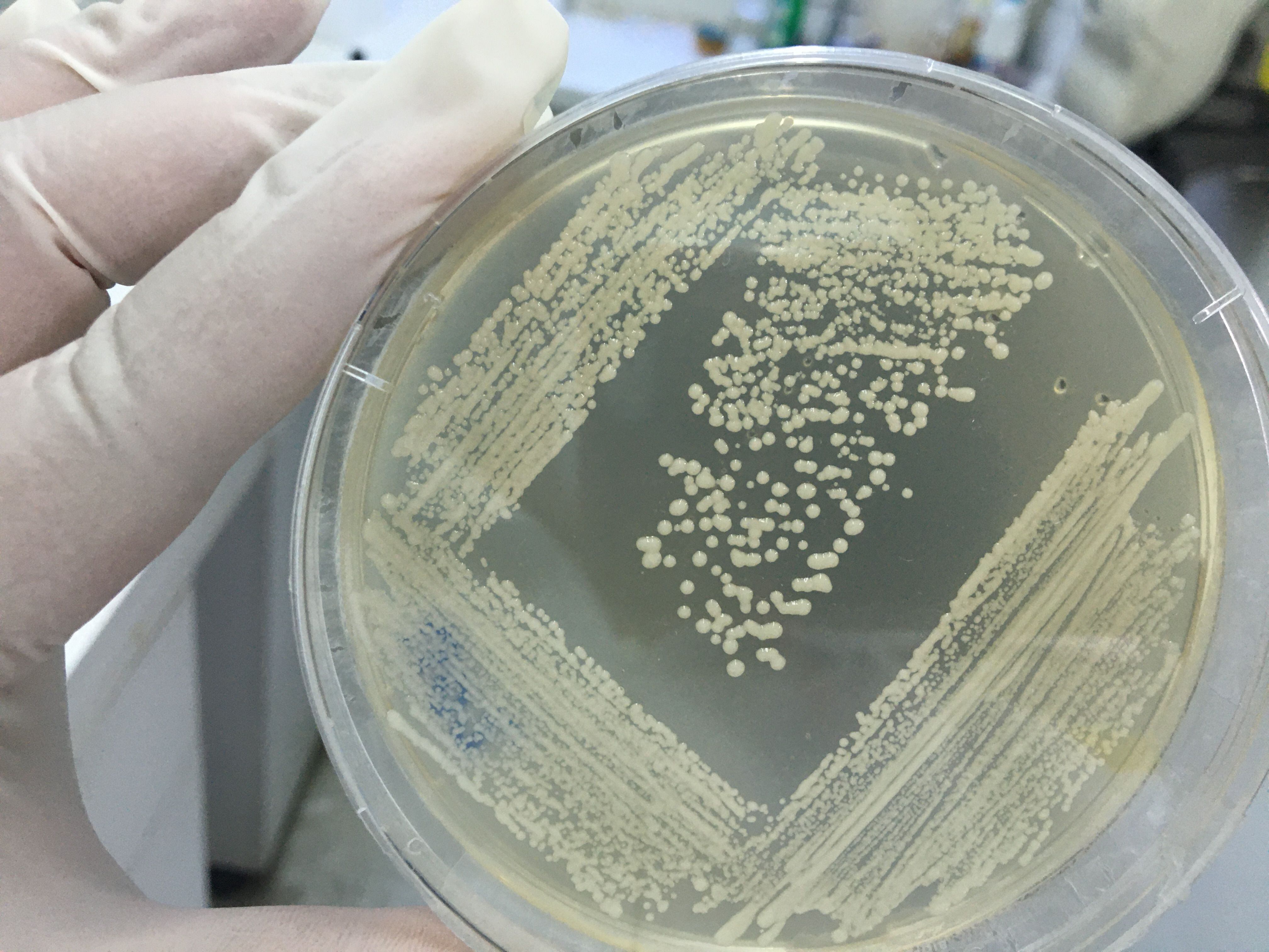 Probiótico contra la bacteria Helicobacter pylori, causante de varias enfermedades gástricas, incluido el cáncer.