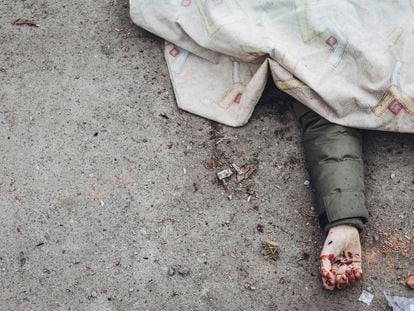 The dead body of a person killed by Russian shelling lays covered in the street in the town of Irpin, Ukraine, Sunday, March 6, 2022. With the Kremlin's rhetoric growing fiercer and a reprieve from fighting dissolving, Russian troops continued to shell encircled cities and the number of Ukrainians forced from their country grew to over 1.4 million. (AP Photo/Diego Herrera Carcedo)