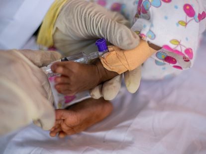 Un bebé de siete meses aquejado de malnutrición es atendido en Yemen, en 2021.
