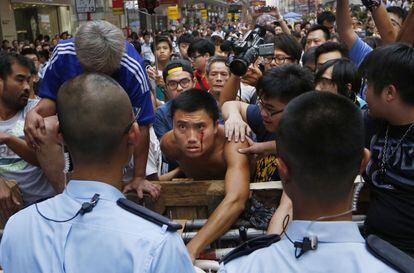 Un manifestante sangra tras un enfrentamiento con un grupo de personas que querian quitar las vallas del centro de Hong Kong. Las protestas y los enfrentamientos entre partidarios y opositores al movimiento prodemocrático se reanudaron, un día después de que se produjera el primer encuentro entre estudiantes y gobierno, que no logró acercar posturas para poner fin a 25 días de conflicto.