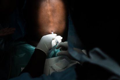 Los pacientes aguardan en la sala de reanimación hasta que el quirófano está preparado y pueden suministrarles la anestesia. Cada intervención, si no se complica, dura algo más de una hora. Tras cinco días y medio, 55 liberianos son operados.