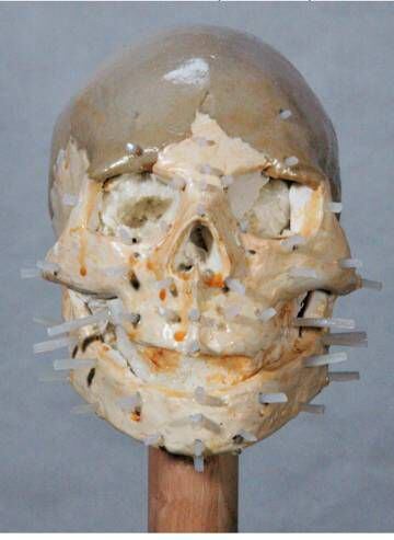 Fase intermedia de la aproximación facial en tres dimensiones.