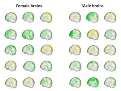El volumen de las distintas regiones cerebrales (en verde, m&aacute;s grande y en amarillo, m&aacute;s peque&ntilde;a) de 42 personas muestra c&oacute;mo se solapan el cerebro masculino y el femenino.