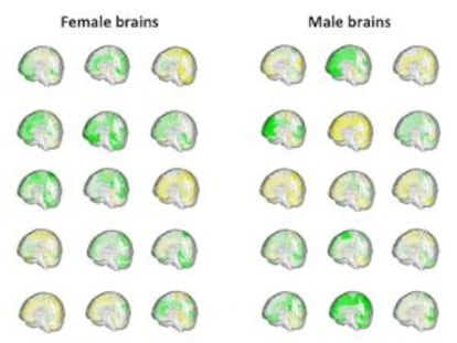 El volumen de las distintas regiones cerebrales (en verde, m&aacute;s grande y en amarillo, m&aacute;s peque&ntilde;a) de 42 personas muestra c&oacute;mo se solapan el cerebro masculino y el femenino.