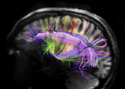 Una resonancia magnética del cerebro humano.