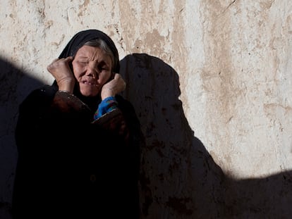 Una mujer con lepra avanzada, en un centro médico de Yawlang, Afganistán, en 2010.