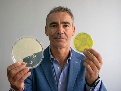 El microbiólogo Bruno González Zorn muestra dos cultivos bacterianos en su despacho de la Universidad Complutense de Madrid.