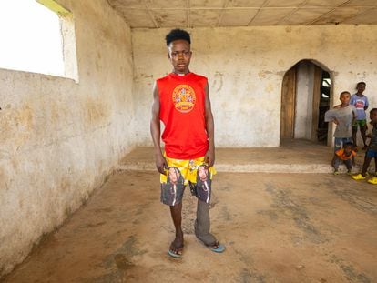 David Sumo tiene 18 años y padece filariasis linfática, una enfermedad transmitida por mosquitos que crea deformidades en las extremidades.