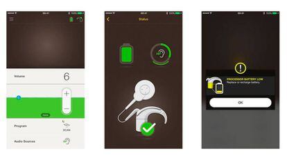 Así es la app que controla el implante coclear para el iPhone