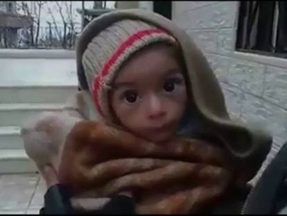 Imagen de una niña siria desnutrida.