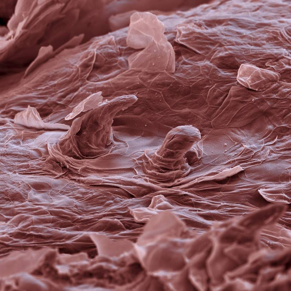 Язык человека под микроскопом фото