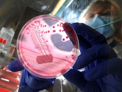 Un cultivo de la bacteria E. coli.