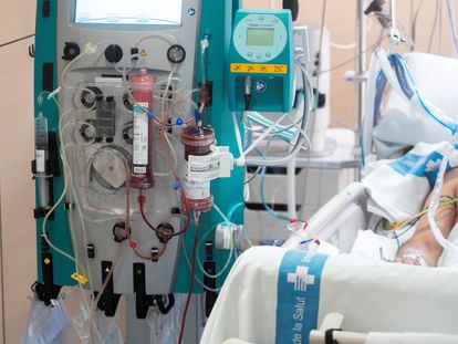 Un paciente con covid se somete al ensayo clínico que filtra la sangre y elimina los virus del torrente sanguíneo, en el hospital Vall d'Hebron de Barcelona.