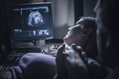 Dos padres miran con atención la ecografía de su futuro bebé.