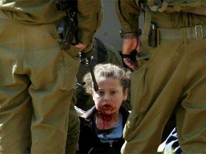 La niña palestina Nesreen Hash, de 8 años, herida por una pelota de goma durante una operación militar israelí en Hebrón (Cisjordania).