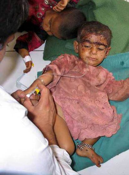 Un niño herido en el bombardeo de la OTAN es tratado en el hospital de Helmand.