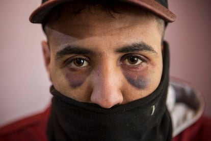 Los migrantes que intentan cruzar la frontera entre Serbia y Croacia son constantemente atacados por la policía